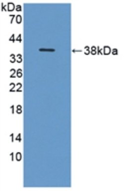 Invitrogen ITIH1 Polyclonal Antibody 200 &mu;L; Unconjugated:Antibodies,