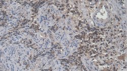 Invitrogen CD50 (ICAM-3) Polyclonal Antibody:Antibodies:Primary Antibodies