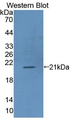 Invitrogen CD50 (ICAM-3) Polyclonal Antibody 20 &mu;L; Unconjugated:Antibodies,