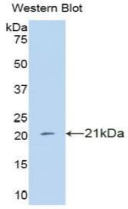 Invitrogen IFNA4 Polyclonal Antibody:Antibodies:Primary Antibodies