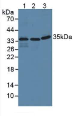 Invitrogen IFI35 Polyclonal Antibody:Antibodies:Primary Antibodies