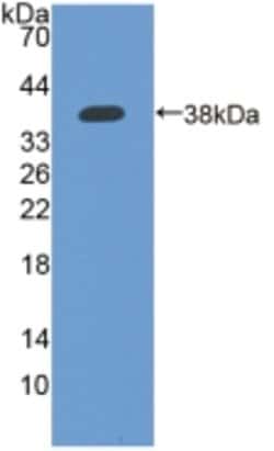 Invitrogen IFI35 Polyclonal Antibody:Antibodies:Primary Antibodies