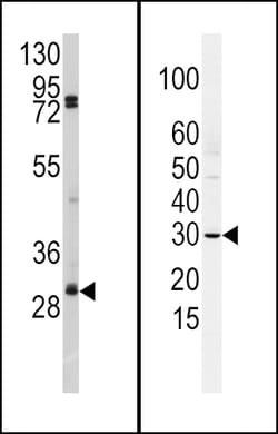 Invitrogen SLUG Polyclonal Antibody 400 &mu;L | Buy Online | Invitrogen&trade; | Fisher Scientific