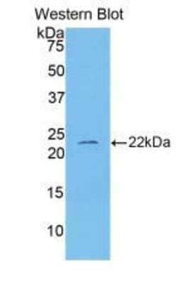 Invitrogen IL-1 beta Polyclonal Antibody 200 μL; Unconjugated:Antibodies,
