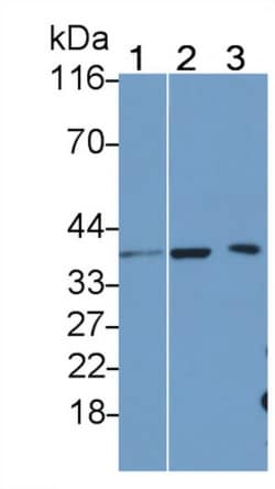 Invitrogen IL-1 beta Polyclonal Antibody 200 μL; Unconjugated:Antibodies,