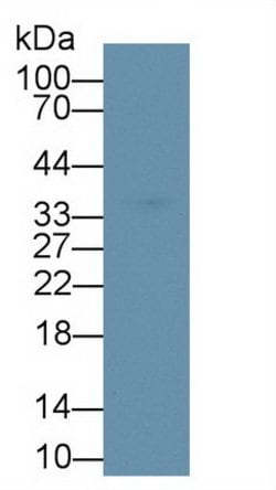 Invitrogen IL-1 beta Polyclonal Antibody:Antibodies, Polyclonal
