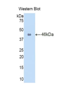 Invitrogen IL-1 beta Polyclonal Antibody 20 &mu;L; Unconjugated:Antibodies,