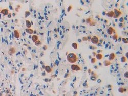 Invitrogen IL-1RAcP Polyclonal Antibody:Antibodies:Primary Antibodies