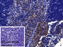 Invitrogen IL-1RAcP Polyclonal Antibody:Antibodies:Primary Antibodies