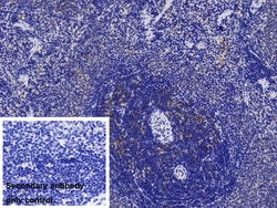 Invitrogen IL-1RAcP Polyclonal Antibody:Antibodies:Primary Antibodies