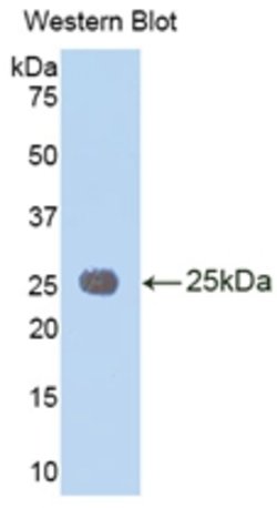 Invitrogen IL-1RAcP Polyclonal Antibody:Antibodies:Primary Antibodies