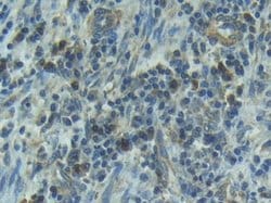 Invitrogen IL1R1 Polyclonal Antibody 200 &mu;L; Unconjugated:Antibodies,