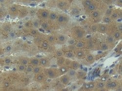 Invitrogen IL1R1 Polyclonal Antibody 200 &mu;L; Unconjugated:Antibodies,