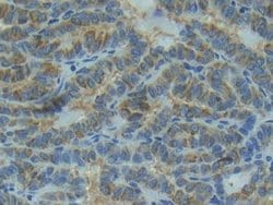 Invitrogen IL1R1 Polyclonal Antibody 200 &mu;L; Unconjugated:Antibodies,