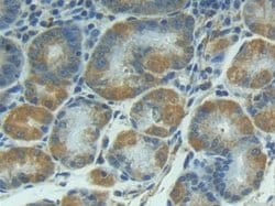 Invitrogen IL1R1 Polyclonal Antibody 200 &mu;L; Unconjugated:Antibodies,
