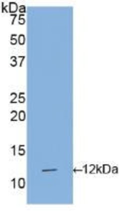 Invitrogen IL1R1 Polyclonal Antibody 200 &mu;L; Unconjugated:Antibodies,