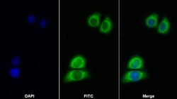 Invitrogen IL11RA Polyclonal Antibody 200 &mu;L; Unconjugated:Antibodies,