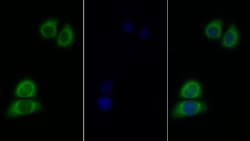 Invitrogen IL11RA Polyclonal Antibody 200 &mu;L; Unconjugated:Antibodies,