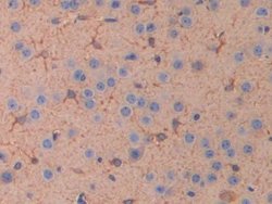 IL11RA Polyclonal Antibody, Invitrogen 200 &mu;L; Unconjugated:Antibodies,