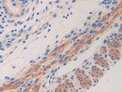 Invitrogen IL11RA Polyclonal Antibody 200 &mu;L; Unconjugated:Antibodies,