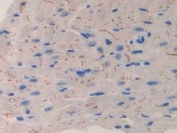 IL11RA Polyclonal Antibody, Invitrogen 200 &mu;L; Unconjugated:Antibodies,