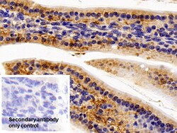 Invitrogen IL11RA Polyclonal Antibody 200 &mu;L; Unconjugated:Antibodies,