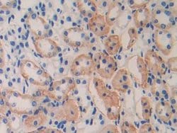 IL11RA Polyclonal Antibody, Invitrogen 200 &mu;L; Unconjugated:Antibodies,