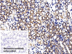 Invitrogen IL11RA Polyclonal Antibody 200 &mu;L; Unconjugated:Antibodies,