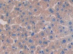 IL11RA Polyclonal Antibody, Invitrogen 200 &mu;L; Unconjugated:Antibodies,