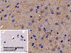 Invitrogen IL11RA Polyclonal Antibody 200 &mu;L; Unconjugated:Antibodies,