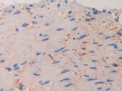 IL11RA Polyclonal Antibody, Invitrogen 200 &mu;L; Unconjugated:Antibodies,