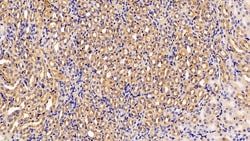 Invitrogen IL11RA Polyclonal Antibody 200 &mu;L; Unconjugated:Antibodies,