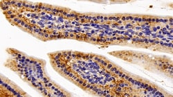 Invitrogen IL11RA Polyclonal Antibody 200 &mu;L; Unconjugated:Antibodies,