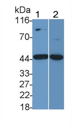 IL11RA Polyclonal Antibody, Invitrogen 200 &mu;L; Unconjugated:Antibodies,