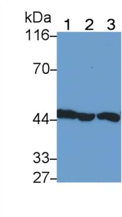 Invitrogen IL11RA Polyclonal Antibody 200 &mu;L; Unconjugated:Antibodies,