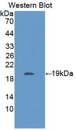 IL11RA Polyclonal Antibody, Invitrogen 200 &mu;L; Unconjugated:Antibodies,