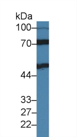 Invitrogen IL11RA Polyclonal Antibody 200 &mu;L; Unconjugated:Antibodies,