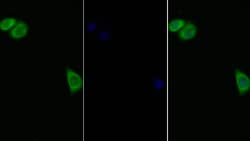 Invitrogen IL11RA Polyclonal Antibody 200 &mu;L; Unconjugated:Antibodies,