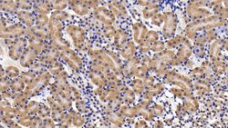 Invitrogen IL11RA Polyclonal Antibody 200 &mu;L; Unconjugated:Antibodies,