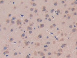 Invitrogen IL11RA Polyclonal Antibody 200 &mu;L; Unconjugated:Antibodies,