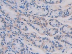 Invitrogen IL11RA Polyclonal Antibody 200 &mu;L; Unconjugated:Antibodies,