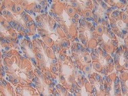 Invitrogen IL11RA Polyclonal Antibody 200 &mu;L; Unconjugated:Antibodies,