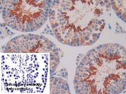 Invitrogen IL11RA Polyclonal Antibody 200 &mu;L; Unconjugated:Antibodies,