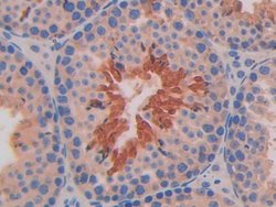 Invitrogen IL11RA Polyclonal Antibody 200 &mu;L; Unconjugated:Antibodies,