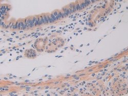 Invitrogen IL11RA Polyclonal Antibody 200 &mu;L; Unconjugated:Antibodies,
