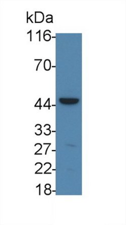 Invitrogen IL11RA Polyclonal Antibody 200 &mu;L; Unconjugated:Antibodies,