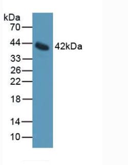 Invitrogen IL11RA Polyclonal Antibody 200 &mu;L; Unconjugated:Antibodies,