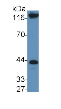 Invitrogen IL11RA Polyclonal Antibody 200 &mu;L; Unconjugated:Antibodies,