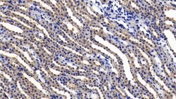 Invitrogen IL11RA Polyclonal Antibody 20 &mu;L; Unconjugated:Antibodies,