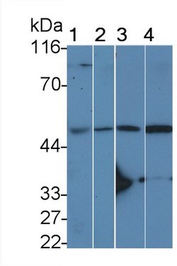 Invitrogen IL11RA Polyclonal Antibody 20 &mu;L; Unconjugated:Antibodies,